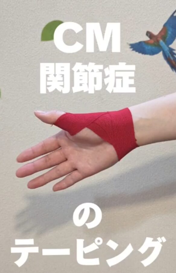 CM関節炎のテーピングの貼り方